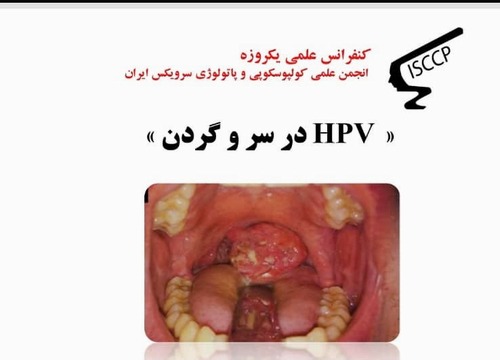 برگزاری کنفرانس علمی یک روزه HPV در سر و گردن در مجتمع بیمارستانی یاس